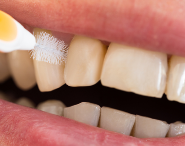 Cleaning between teeth: the secret behind a healthy smile